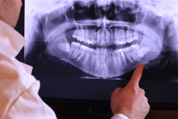 Best Emergency Dental Extractions in Hutchins, TX