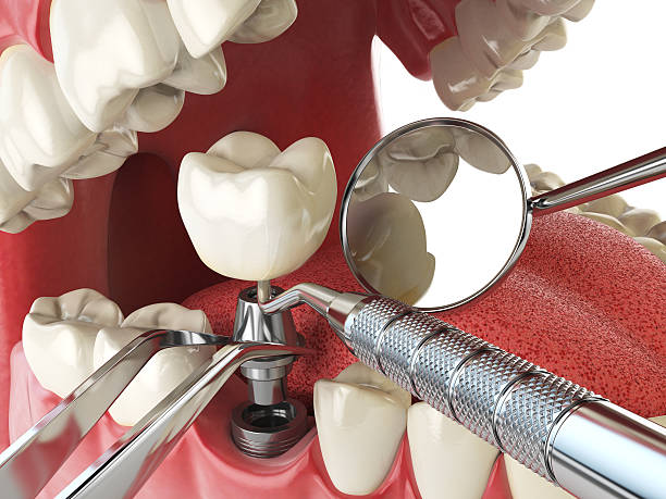 Best Emergency Dental Services for Seniors in Hutchins, TX